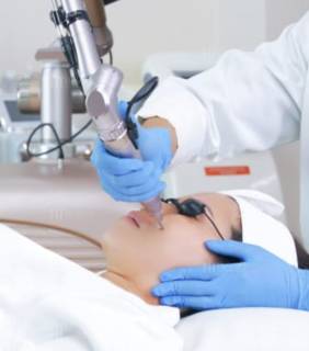 Điều Trị Nám Công Nghệ Phun Nano