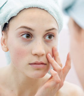Điều Trị Thâm Quầng Mắt